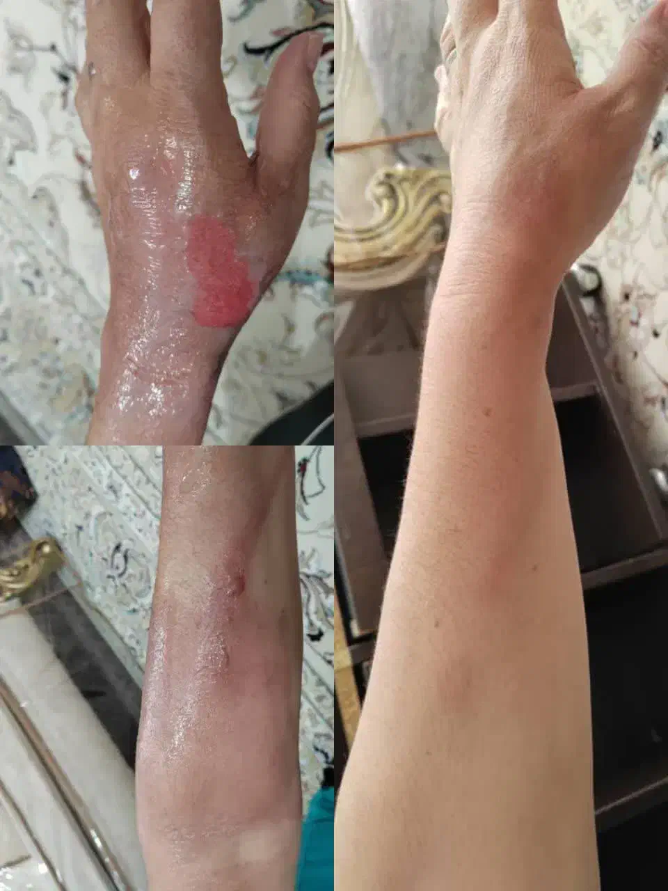 کلینیک تخصصی درمان زخم ( بستر و دیابت) فردوس|خدمات آرایشگری و زیبایی|اصفهان, بهار آزادی|دیوار