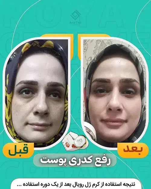 کرم ضدلک|آرایشی، بهداشتی، درمانی|شیراز, شهرک استقلال|دیوار