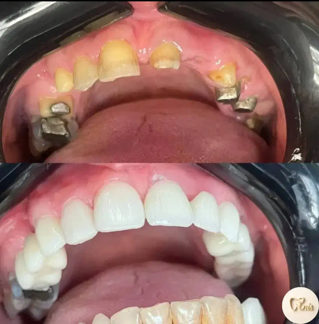 دندان پزشکی|خدمات آرایشگری و زیبایی|قم, نوقطار|دیوار