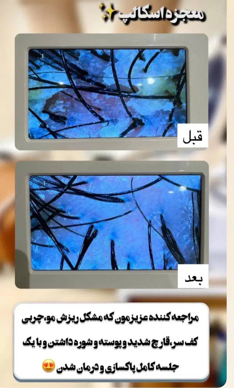 آموزش اسکالپ سر با ضمانت یادگیری/شروع کلاس 1آذر|خدمات آموزشی|قم, سالاریه|دیوار