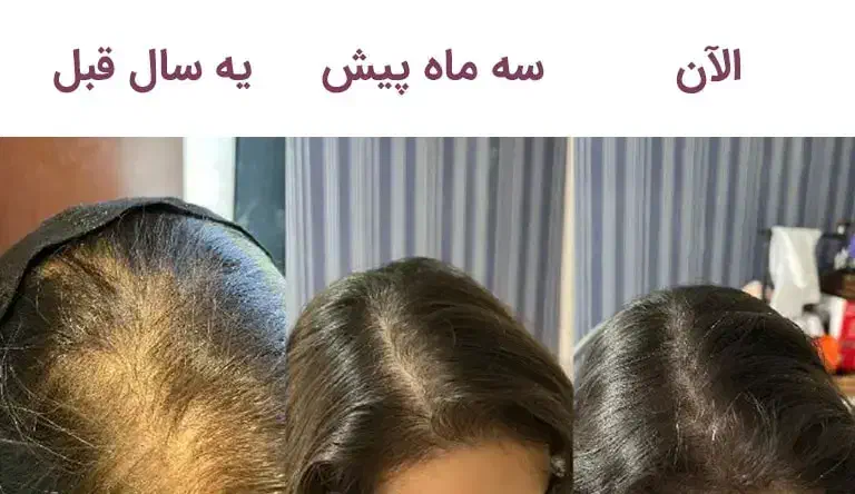 تونیک هیر فرند گیاهی|آرایشی، بهداشتی، درمانی|اصفهان, کوی امیریه|دیوار