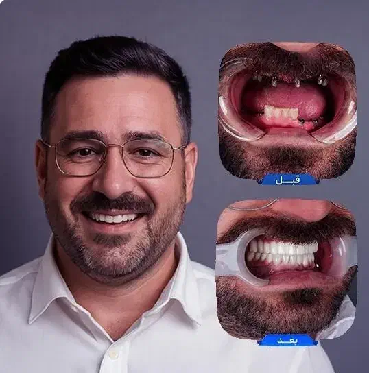 بیمه دندانپزشکی کامپوزیت زیبایی طلایی شو|خدمات آرایشگری و زیبایی|گرگان, |دیوار