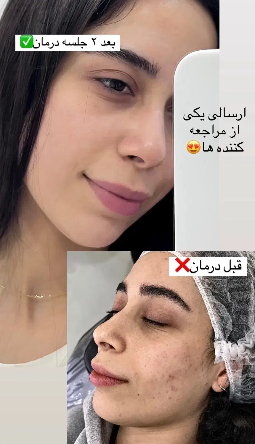 درمان مشکلات پوستی|خدمات آرایشگری و زیبایی|شاهین دژ, |دیوار