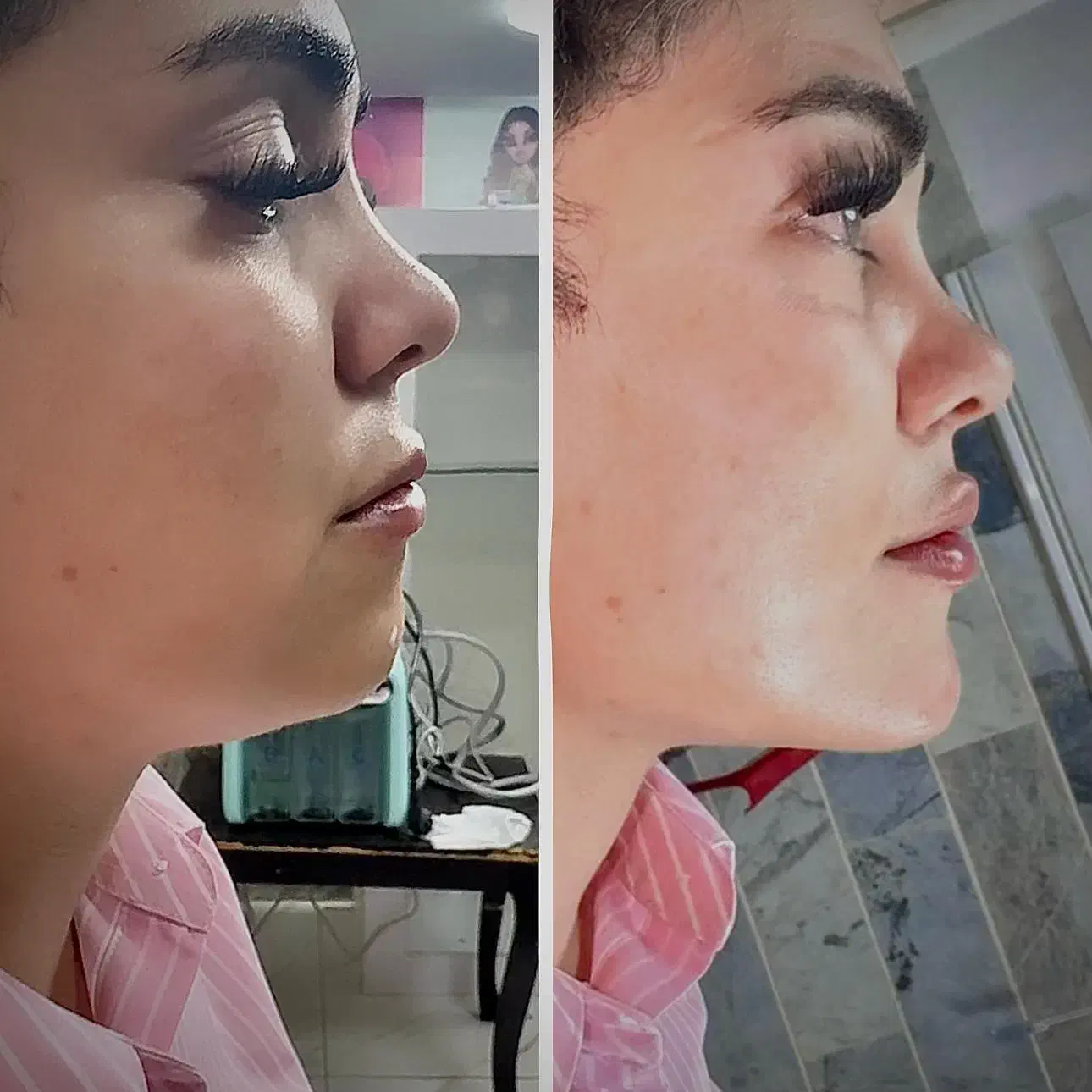 جشنواره فیلرو بوتاکس با قیمت باور نکردنی در مطب|خدمات آرایشگری و زیبایی|کرج, گوهردشت|دیوار