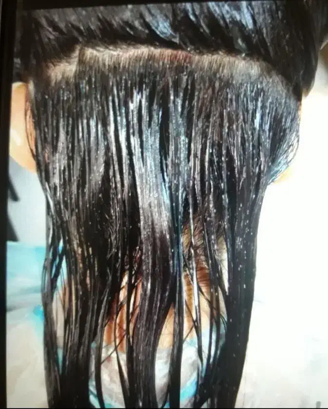 مرکز تخصصی رفع شپش|آرایشی، بهداشتی، درمانی|قم, خداکرم|دیوار