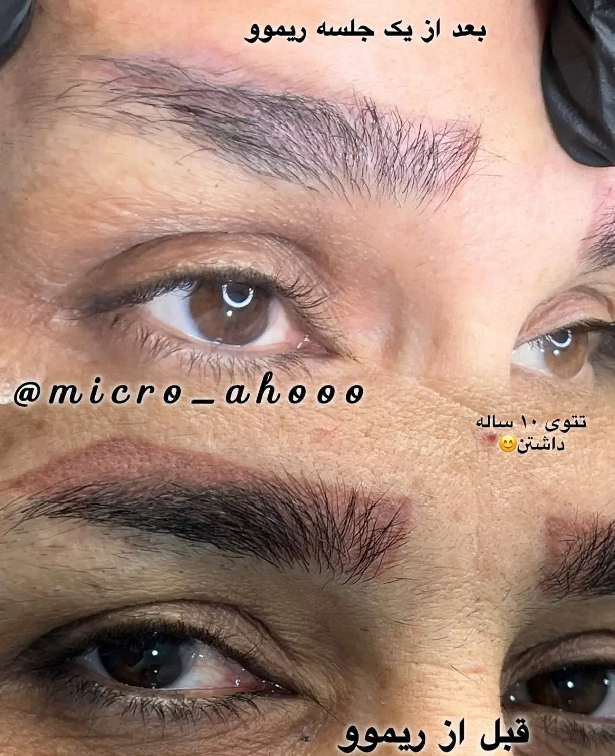 دیگه نگران تکرار زیاد جلسات پاک شدن تتوت نباش|خدمات آرایشگری و زیبایی|بندر گناوه, |دیوار