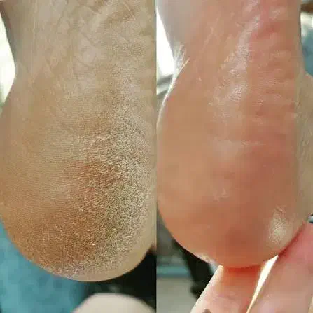 پدیکور پا|خدمات آرایشگری و زیبایی|چرام, |دیوار