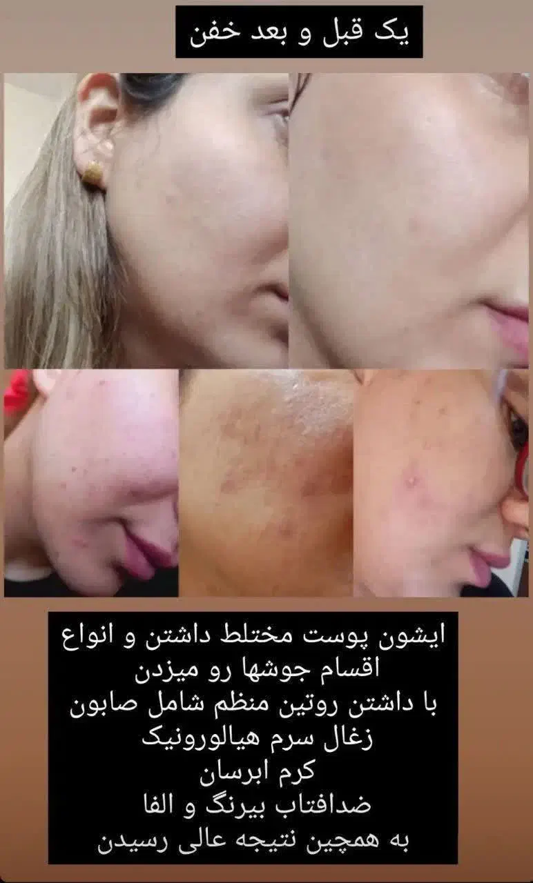 سارا محمدپور هستم|آرایشی، بهداشتی، درمانی|تهران, آزادشهر|دیوار