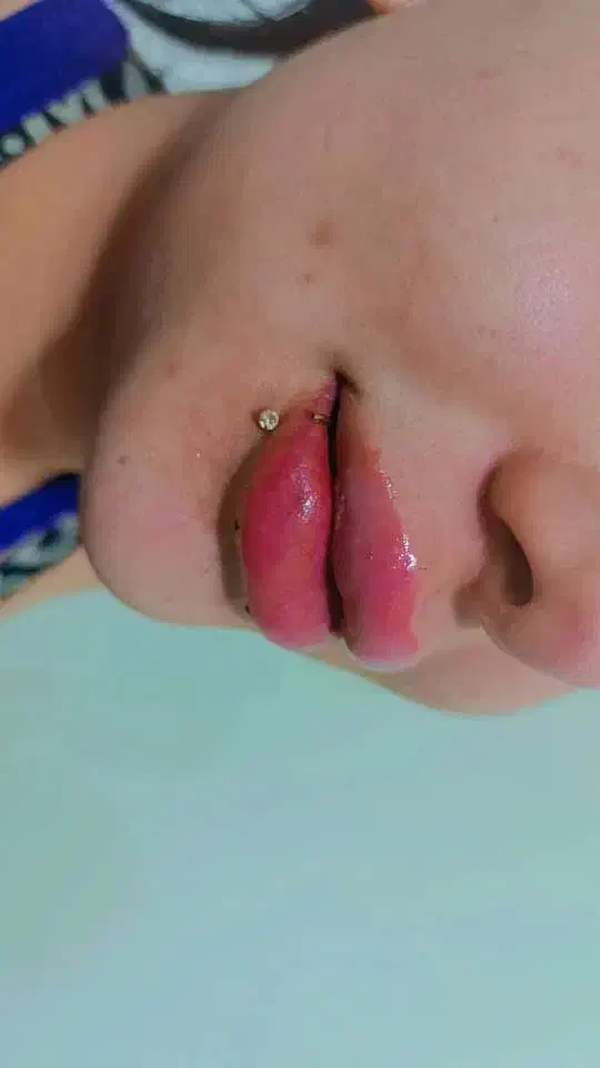 ژل فیلر بوتاکس آفر ویژه|خدمات آرایشگری و زیبایی|شیراز, سلطان آباد|دیوار