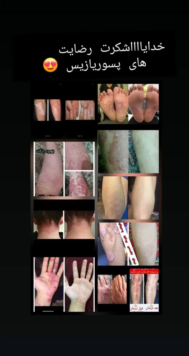 آموزش روغن درمانی ویژه|خدمات آموزشی|خاش, |دیوار