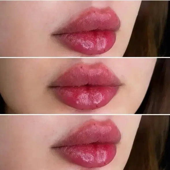 ژل لب 790 بوتاکس چشم گربه ای 290.بوتاکس۶۵۰ میدفیس|خدمات زیبایی و سلامت|مشهد, احمدآباد|دیوار