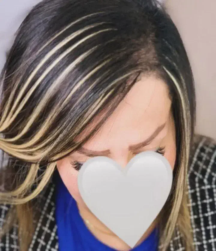 مو لیزری|حراج|ملایر, |دیوار