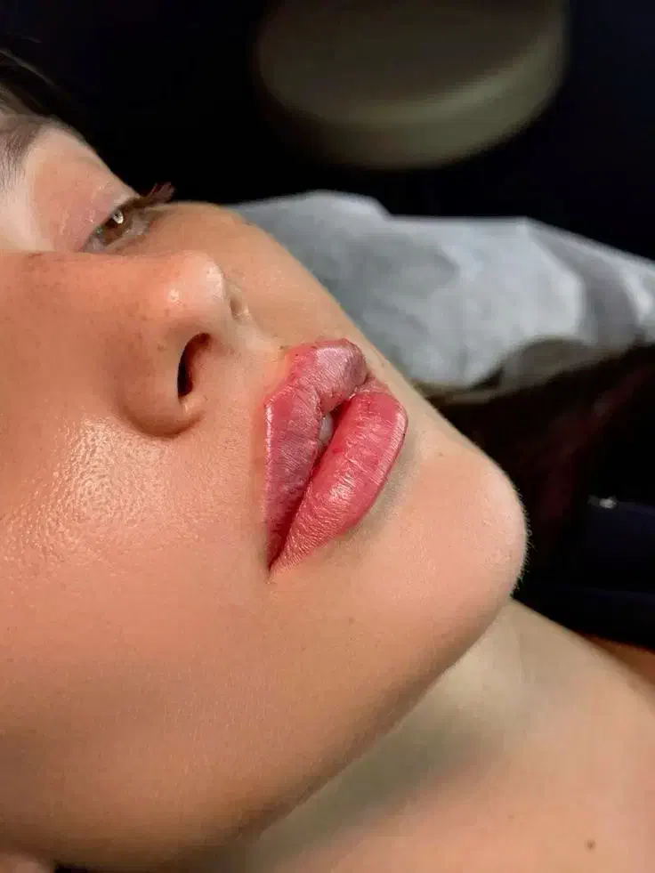 تخفیف تزریق ژل و بوتاکس برای خانم ها و آقایون|خدمات آرایشگری و زیبایی|شاهینشهر, خانه کارگر|دیوار