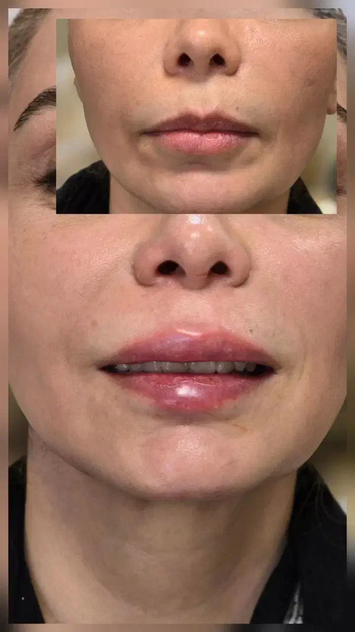 پوست،مو،زیبایی،دکتر تدین زاده|خدمات آرایشگری و زیبایی|کرج, فاز ۳ گوهردشت|دیوار