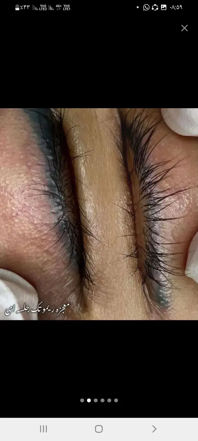 ریموور تخصصی  تاتو با مواد اصل آمریکایی با ضمانت|خدمات آرایشگری و زیبایی|جیرفت, |دیوار