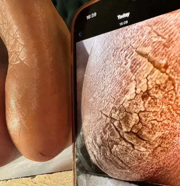 پدیکور|خدمات آرایشگری و زیبایی|بندر انزلی, تهران|دیوار