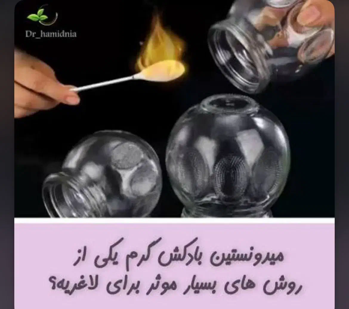 آموزش بادکش درمانی (سرد و گرم )|خدمات آموزشی|لردگان, |دیوار