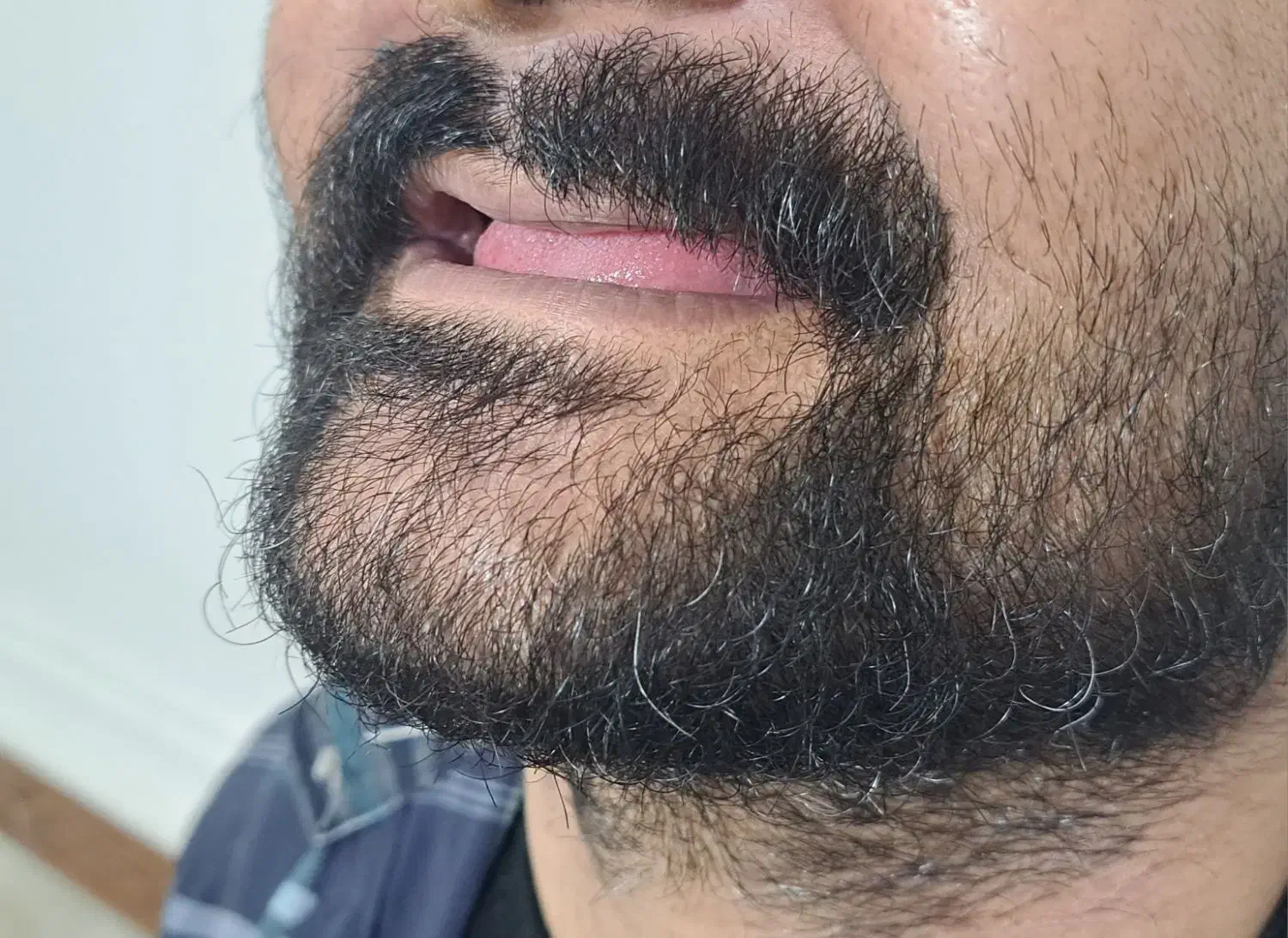 دندانسازی تخصصی|خدمات آرایشگری و زیبایی|بهبهان, |دیوار