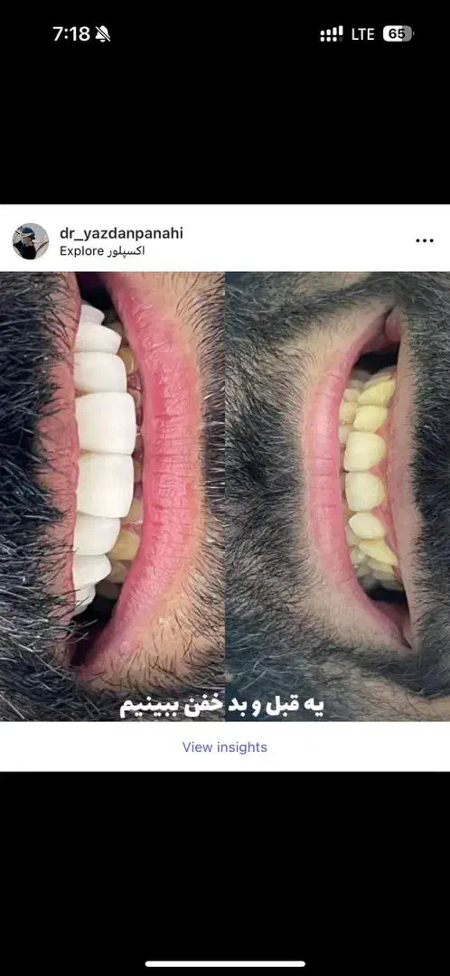 انجام کلیه خدمات دندانپزشکی قرارداد بانک سپه ورفاه|خدمات آرایشگری و زیبایی|فلاورجان, |دیوار