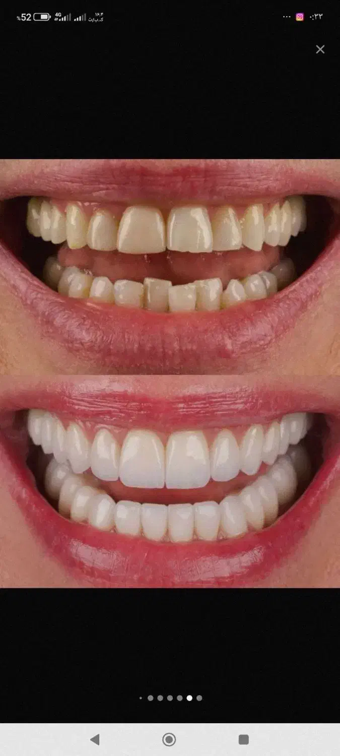 اموزش لابراتوار به صورت حرفه ای|خدمات آموزشی|تبریز, |دیوار