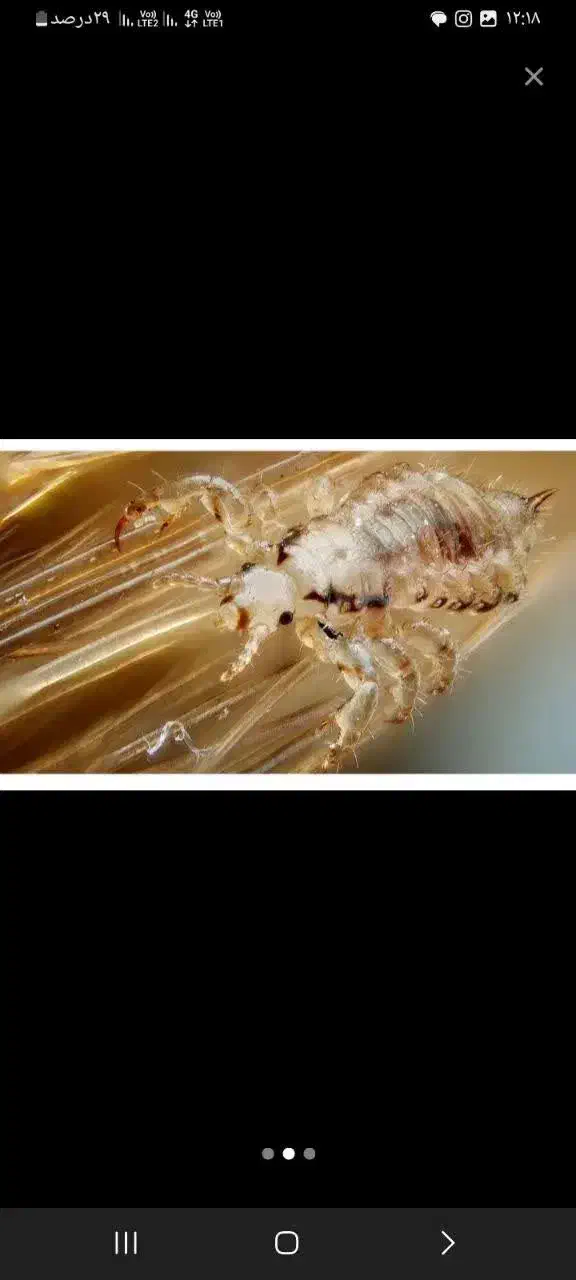 شپش|آرایشی، بهداشتی، درمانی|اصفهان, باغ فردوس|دیوار