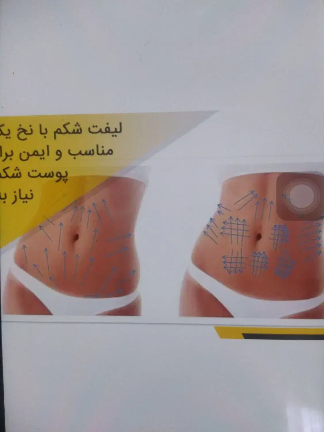 لاغری|آرایشی، بهداشتی، درمانی|شیراز, تندگویان|دیوار