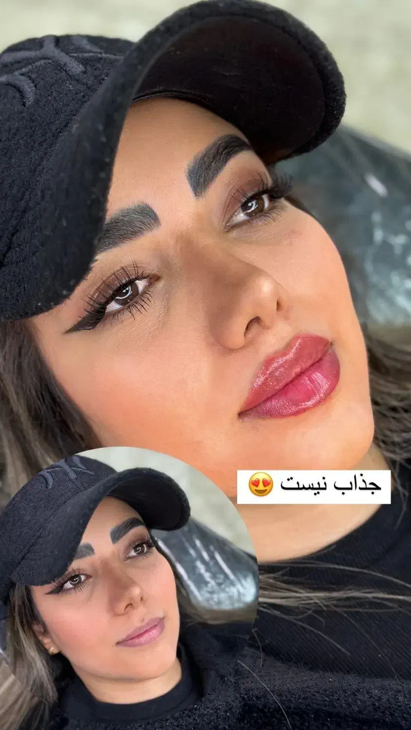 تخفیف ویژه فیلر هر سی سی ۶۰۰هزارتومان اصلی تضمینی|خدمات آرایشگری و زیبایی|فولادشهر, B2|دیوار