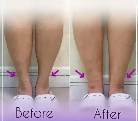 آفر ویژه خدمات زیبایی ژل فیلر بوتاکس لیفت|خدمات آرایشگری و زیبایی|شاهینشهر, طالقانی|دیوار