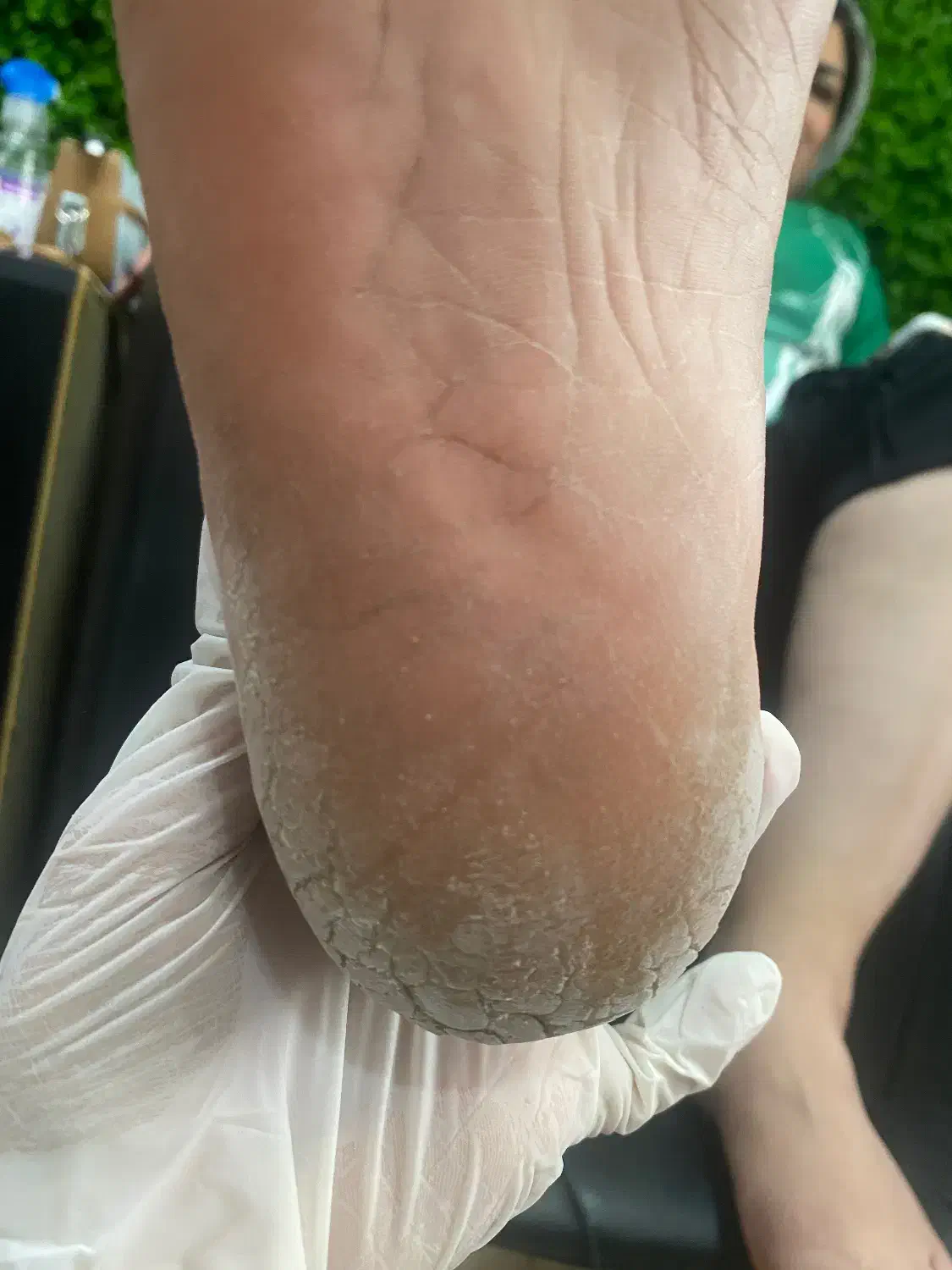 -رفع ترک و پینه پا با تکنیک تخصصی|خدمات آرایشگری و زیبایی|قائم‌شهر, |دیوار