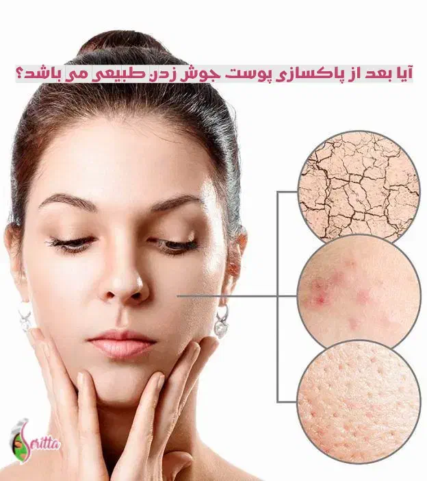 پاکسازی صورت|خدمات آرایشگری و زیبایی|بیرجند, |دیوار
