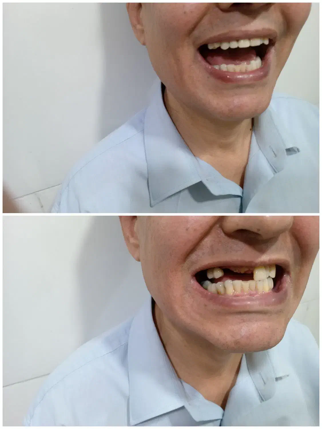 دندانسازی مصنوعی حرفه ای برای همه لبخندها|خدمات آرایشگری و زیبایی|مشهد, کوی سیدی|دیوار