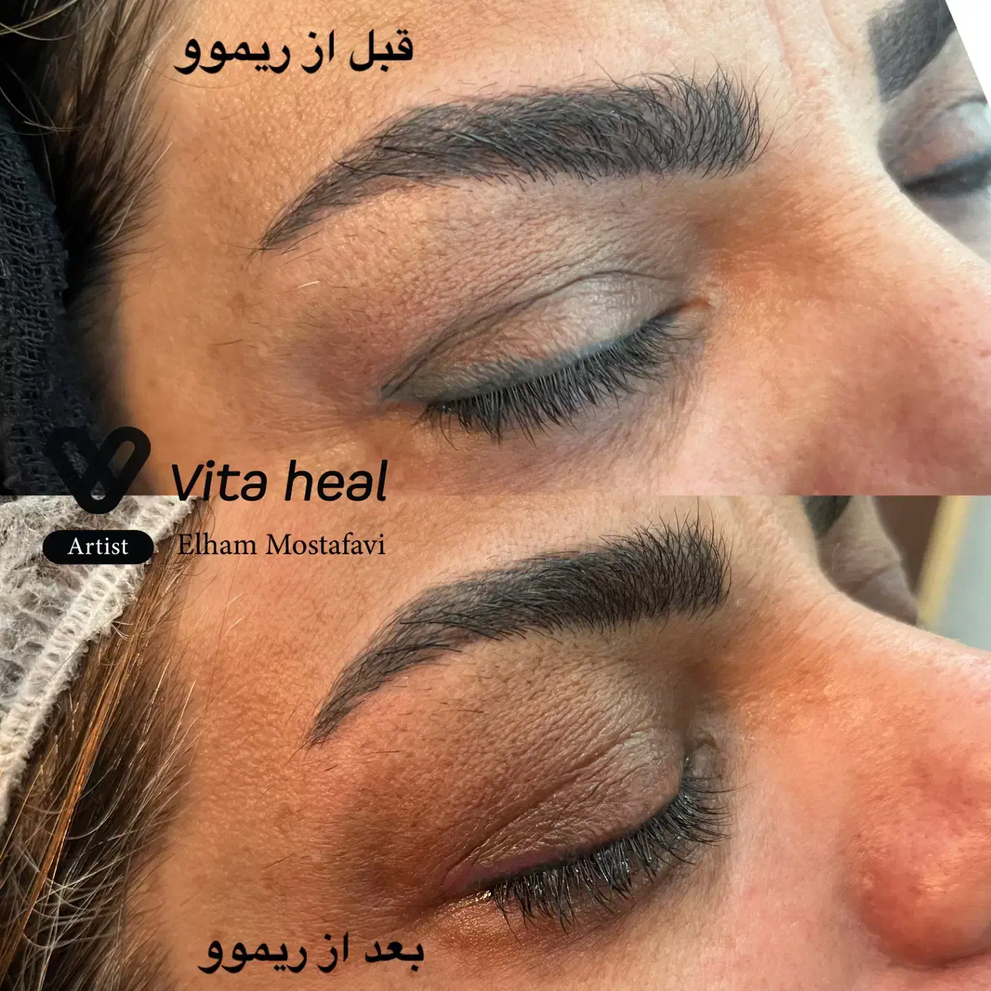 جشنواره یلدایی ریموو تخصصی تتو ابرو چشم و لب|خدمات آرایشگری و زیبایی|شیراز, تندگویان|دیوار