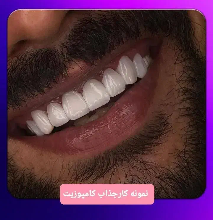 دندان سازی ویتا خدمات و ساخت دندان|پزشکی|بابل, |دیوار