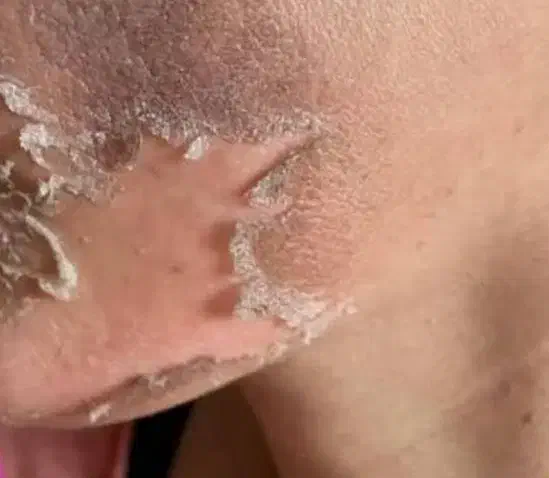 آموزش آلگاپیل (تکنیک پوست مار)|خدمات آموزشی|لنجان, |دیوار