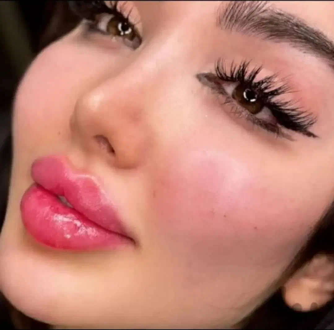 کلینیک جراحی نخ آنزیم غبغب مزو ژل فیلر بوتاکس|خدمات آرایشگری و زیبایی|کرج, گوهردشت|دیوار