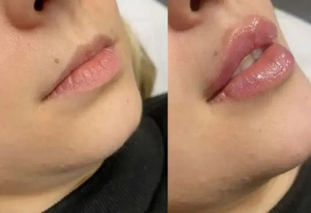 کلینیک تخصصی زیبایی/بوتاکس فیلر لاغری مزو PRP|خدمات آرایشگری و زیبایی|رفسنجان, |دیوار