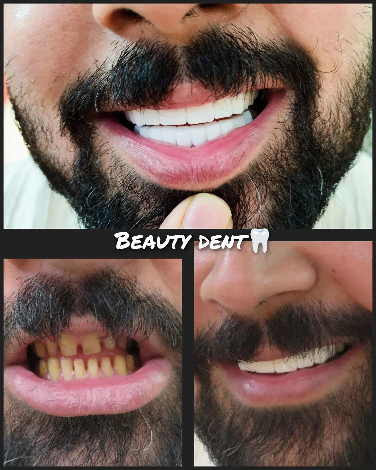 دندانسازی دندان سازی|پزشکی|مشهد, سرافرازان|دیوار