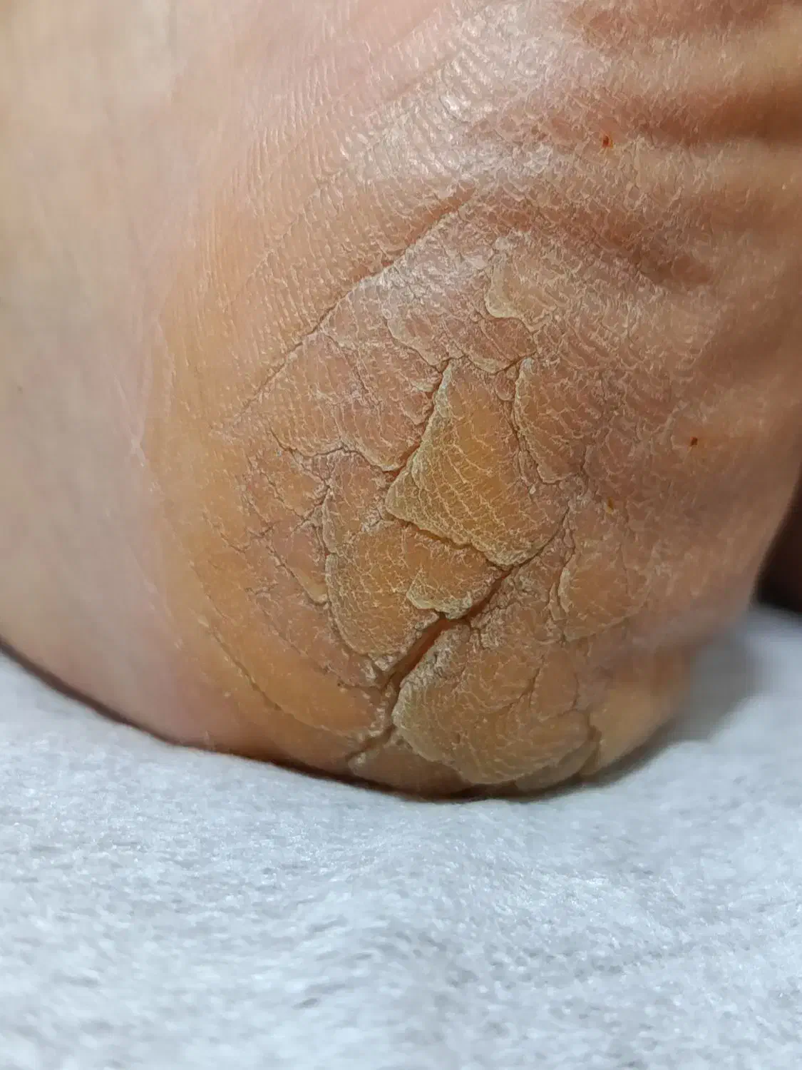 پدیکور و کفسابی تضمینی با پارافین تراپی|خدمات آرایشگری و زیبایی|شاهین‌شهر, عطار|دیوار