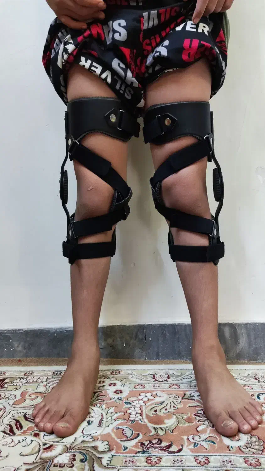 زانوبند طبی|آرایشی، بهداشتی، درمانی|کرج, شهرک اوج|دیوار