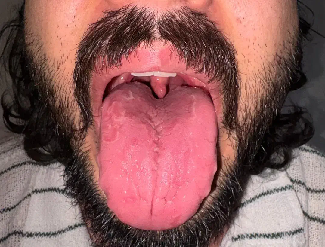 زبانشناسی و مزاجشناسی و درمان با محصولات گیاهی|خدمات آرایشگری و زیبایی|کارون, |دیوار