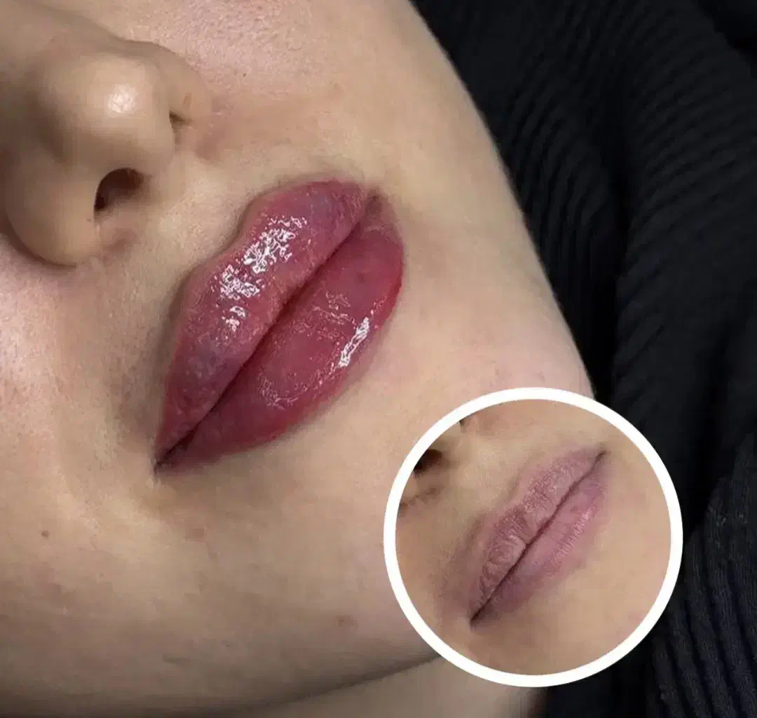 لیدر زیبایی ژل و بوتاکس و کاشت مو|استخدام درمانی، زیبایی، بهداشتی|کرمانشاه, |دیوار