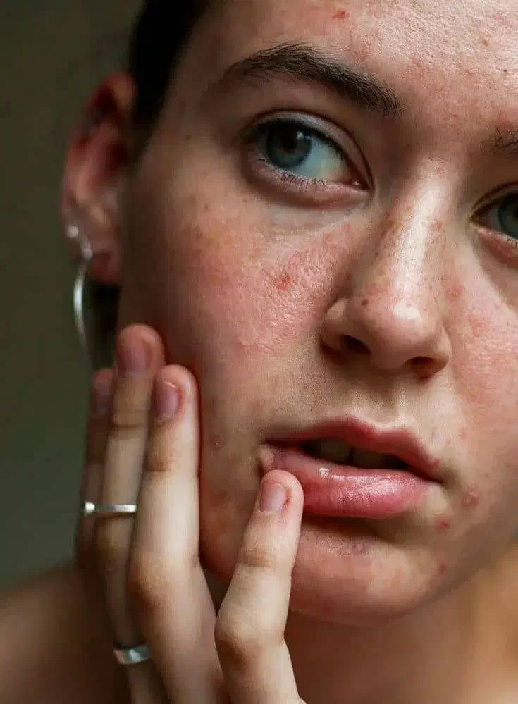 پوست زیبا|فعالیت داوطلبانه|کرمان, |دیوار