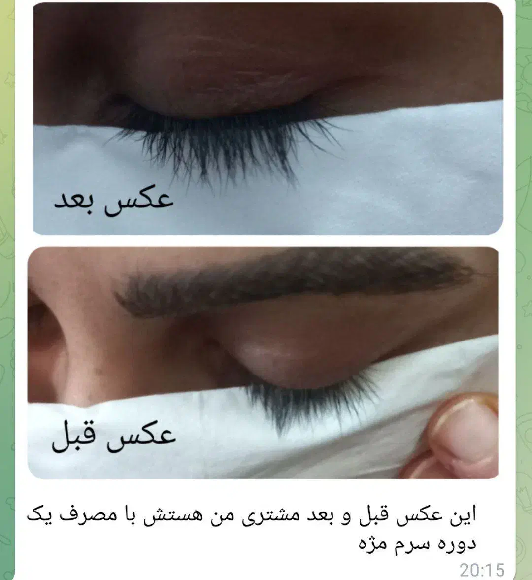 مشاور پوست و مو|آرایشی، بهداشتی، درمانی|قم, وادی السلام|دیوار