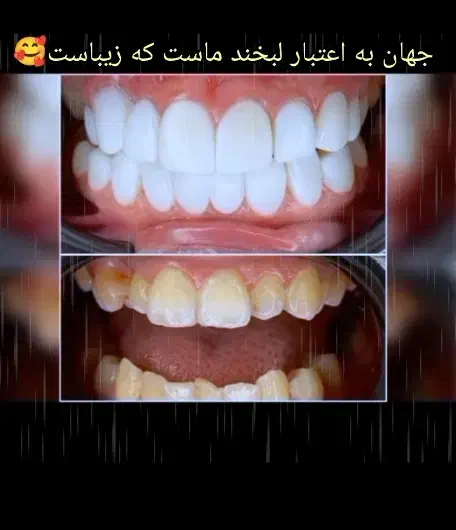 مژده مژده کامپوزیت برای یک ماه  تخفیف ویژه|خدمات آرایشگری و زیبایی|یاسوج, |دیوار