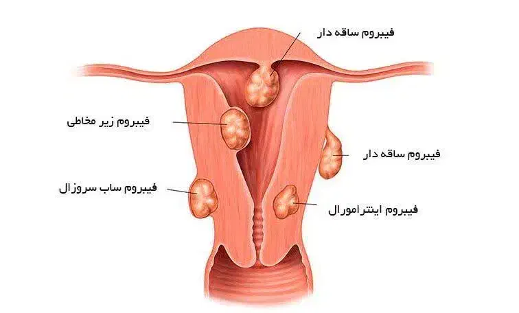 زن وسلامت|آرایشی، بهداشتی، درمانی|زاهدان, |دیوار