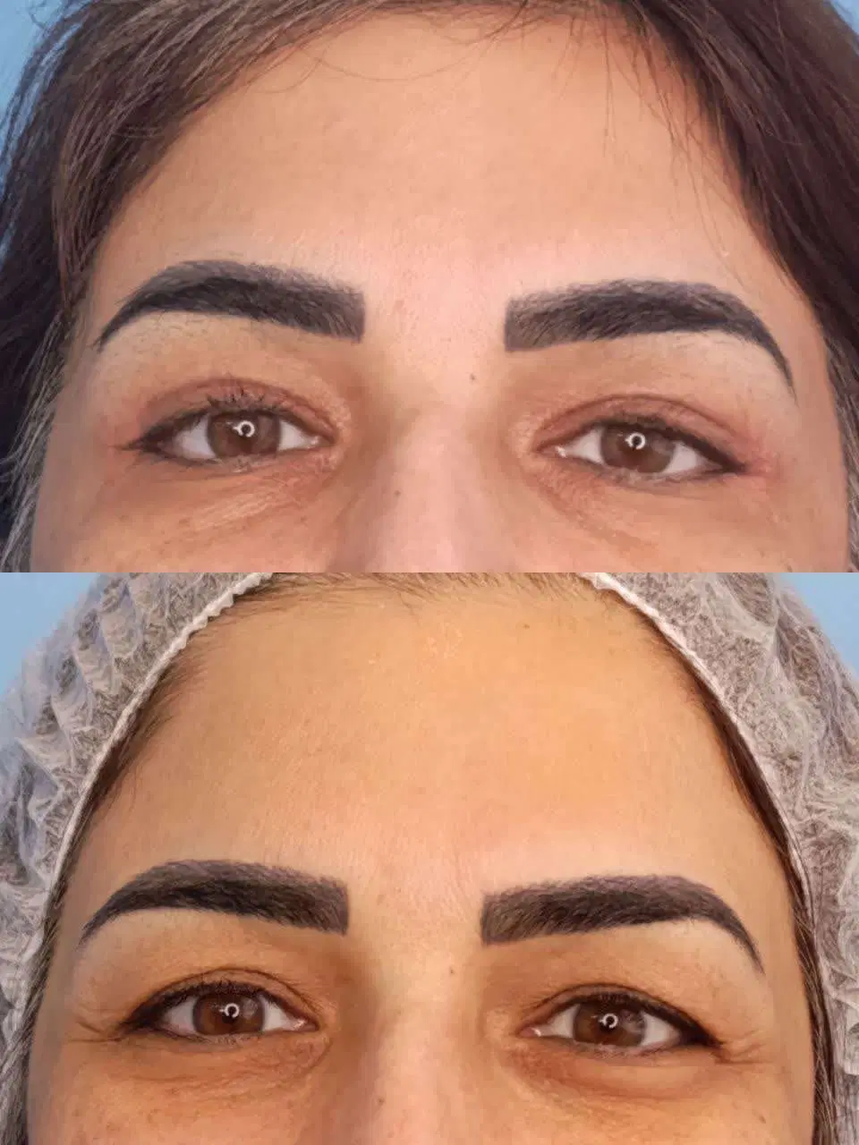 جشنواره عمل های زیبایی (اقساطی)|خدمات زیبایی و سلامت|اصفهان, سعادتآباد|دیوار