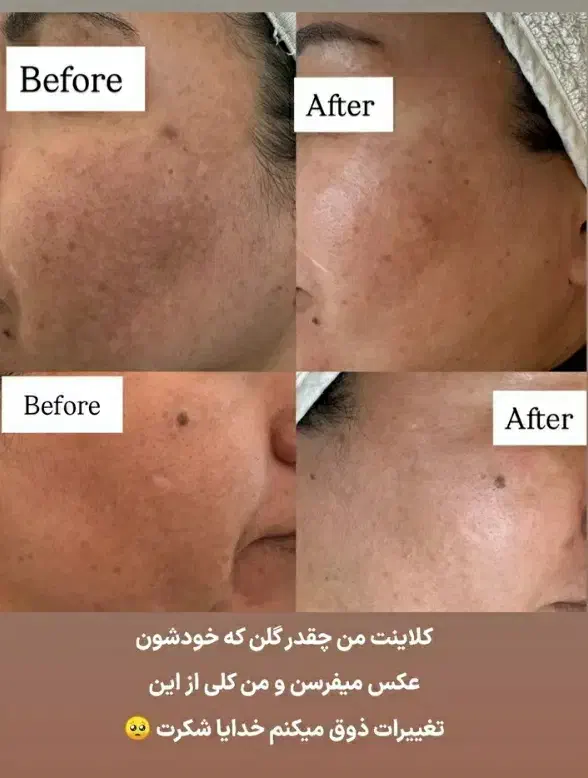 مدل کاشت ناخن و فشیال و اصلاح|خدمات آرایشگری و زیبایی|پرند, فاز ۴|دیوار