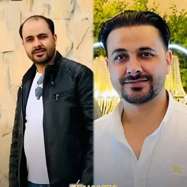 کاشت مو|خدمات آرایشگری و زیبایی|کرمانشاه, |دیوار
