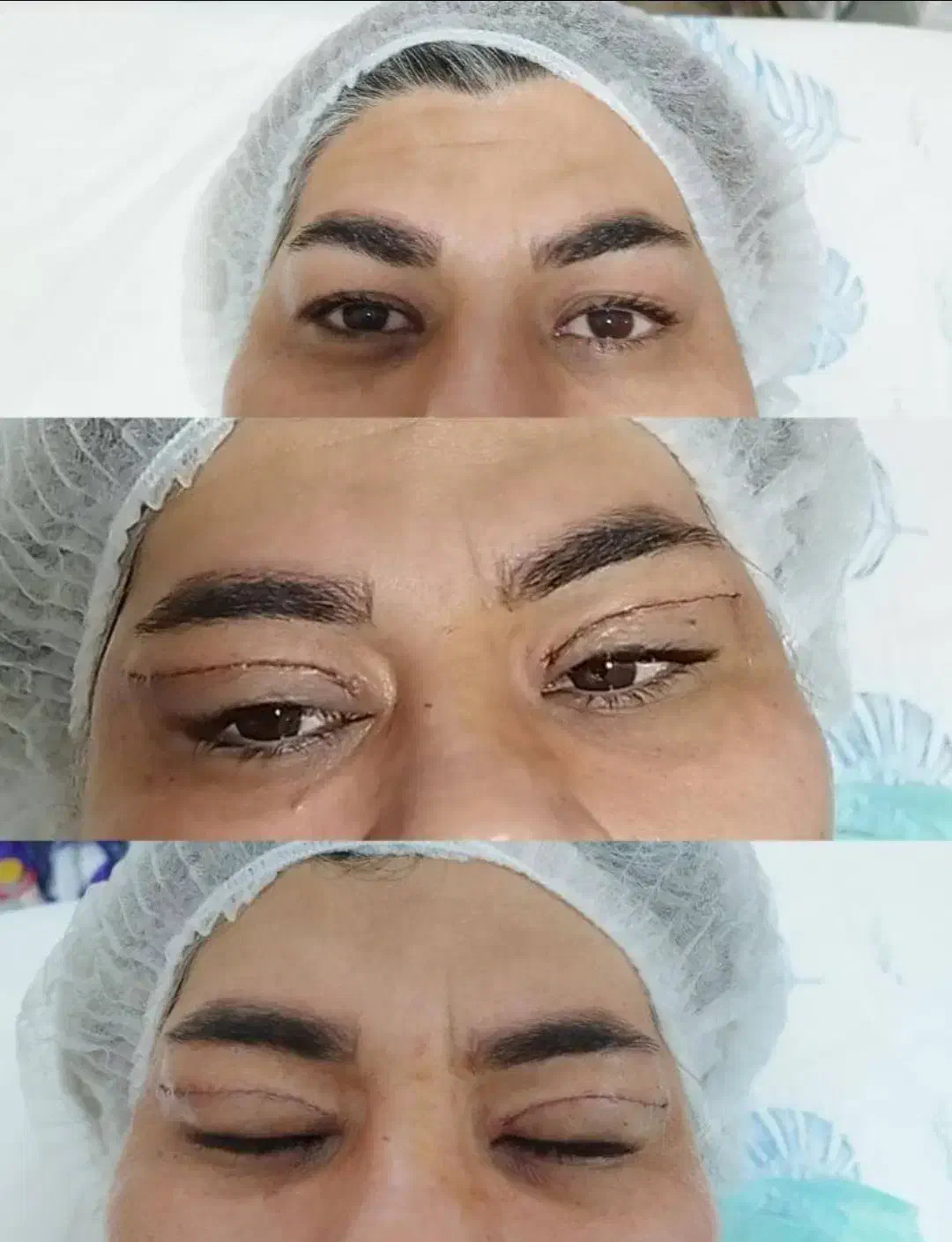 مژده همشهریان عزیزتخفیف 30 درصد خدمات جراحی ساکشن|خدمات آرایشگری و زیبایی|بروجرد, |دیوار