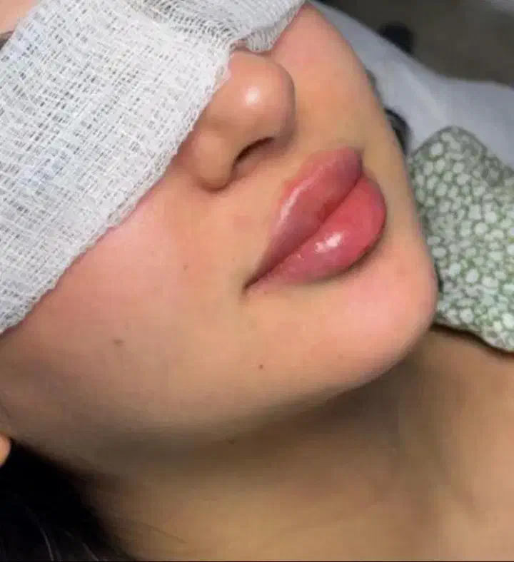 ژل و بوتاکس|خدمات آرایشگری و زیبایی|کارون, |دیوار